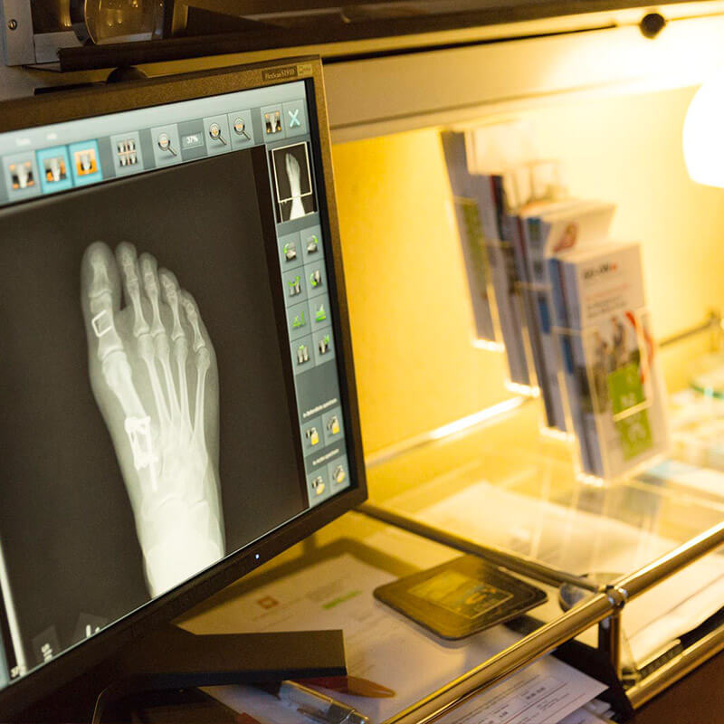 Beinverlängerung München Beinzentrum in Bayern